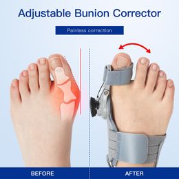Hot Adjustable Bunions Toe Corrector Hallux Valgus Corrector Toe Separator Pain Relief Orthopaedic Supplies Pedicure Foot Care