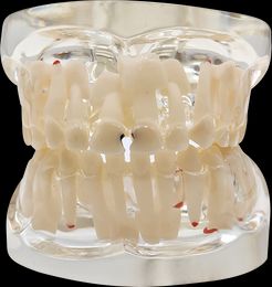 Kids Dental Model Teeth Teaching Model Children Permanent Deciduous Teeth Typodont Dentist Paediatric Dentistry Child Tooth Model