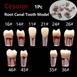 1Pc Dental Root Canal Tooth Teaching Model Endo Training Block Tooth Dentistry RCT Students Practice Medullary Pulp Cavity Resin