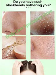 Nose Blackhead Remover Mask Deep Cleansing Skin Care Shrink Pore Acne Treatment Mask Nose Black dots Pore Clean