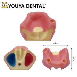 Dental Implant Teaching Model Edentulous Maxillary Sinus with Soft Gums Teeth Implant Practise Training Studying Model