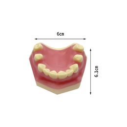 Dental Implant Teeth Model Practise Demo Typodont For Dentist Student Studying Teaching Models Dentistry Laboratory Products