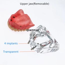 Dental Overdenture Superior upper/Lower jaw for Teaching Study 4 Implants/2 Implants Teeth Model