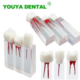 Dental Root Canal Tooth Model Teeth Endodontic Pulp Cavity RCT Demo Model For Dentist Student Study Practise Dentistry Tools