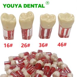 Dental Tooth Model Root Canal Block RCT Practice Teeth Pulp Cavity Resin Teeth Study Endo Training Model Dentistry Product