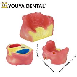 Implant Teaching Model Edentulous Maxillary Sinus with Soft Gums for Dentist Student Training Teaching Model