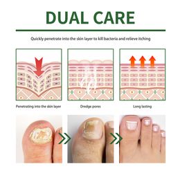 Peeling Dead Skin Foot Masks Anti Crack Nail Repair Feet Masks Brightening Skin Update Whitening Feet Mask Products 1-5 pairs