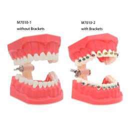 Dental Typodont Orthodontic Teeth Model with Metal Braces Standard Size For Dentistry Teaching Studying
