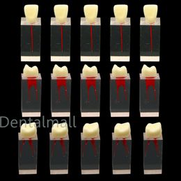 5Pcs Dental Root Canal Teeth molar Model Study Practise For Endodontic Pulp File