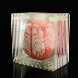 Brain Specimen Coasters Set 3D Organ Brain Artwork Brain Slices Square Acrylic Glass Drinks Table Coaster Drunk Scientists Gift