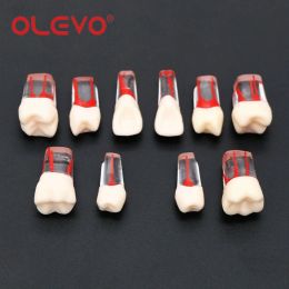 OLEVO Dental Teeth Endo Root Canal Pulp Files Practice Endodontic Blocks Clear Resin Model 10 Sizes Dentistry Material M8006