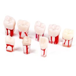 5pcs Dental Tooth Model Root Canal Models Endodontic Training Block RCT Practice Student Dentistry Teaching