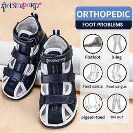 Sandals Princepard 2022 Children Orthopedic Shoes for Flat Feet Summer Kids Footwear Closed Toe Boys Girls Sandals with Ankle Support 240419