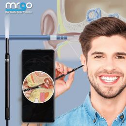 Cameras Clean Ear Endoscope Camera Mini Borescope Mobile Otoscope Probe Micro for Android Smartphone Endoscopic Camera Endoscope Usb C