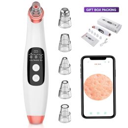 Scrubbers Bji Visual Blackhead Remover Vacuum Suction Pore Cleaner Acne Point Wifi Black Spot Extractor Facial Cleansing Tool Dropshipping