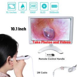 Trimmers 10.1Inch Screen Digital Otoscopio Ear Cleaning Endoscope 1080P Visual Otolaryngoscope ENT Camera Cleaner Tool Home Clinic Use