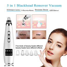 Scrubbers Tinwong Blackhead Remover Vacuum, Electric Facial Comedo Suction Pore Cleaner Extractor Tool,5 Replaceable Suction Heads