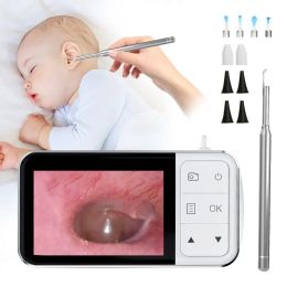 Lens 4.5 Inch LCD Digital Otoscope 3.9mm 1080P Ear Scope Camera with 6 Lights Ear Wax Removal Tool for Kids Adults With Carring Bag