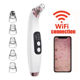 Scrubbers Blackhead Remover Pore Vacuum with Camera Upgraded Face Pore Cleanser Wifi Realtime Visual with 3 Adjustable Suction &5 Probes