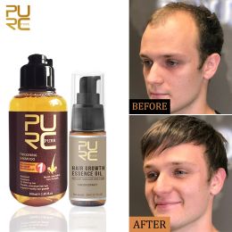 Shampoo&Conditioner PURC Hair Growth Shampoo Set Ginger Anti Hair Loss Fast Regrowth Care Oil Scalp Treatment Kit Hair Growth Products for Men Women