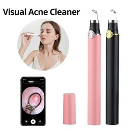 Smart Visual Acne Needle with 20X Camera Blackhead Pore Cleansing Beauty Instrument Pore ction Tools Acne Cleaner 240422