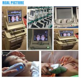 2024 Focused Ultrasound Hifu Laser Lifting Hifu 4d Facial Hifu 10d Machine Best Selling Ultrasonic Cartridge 13mm Liposonic