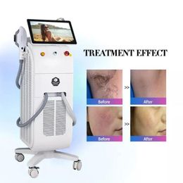 Latest Diode laser hair removal machine 2 handle ice platinum titanium price lazer hair remove salon beauty application