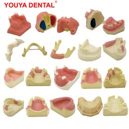 Other Oral Hygiene YOUYA 1PCS Dental Model Teeth Implant Practice Model Tooth Dental Implant Model Training Display Dentistry Oral Teaching Models 230815