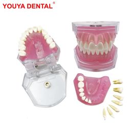 Other Oral Hygiene Transparent Dental Model Tooth Root Visible Dental Typodont Model With Removable Teeth Soft Gum Tooth Extraction Pratice Models 230815