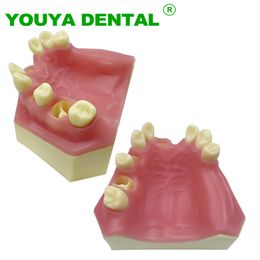 Other Oral Hygiene Dental Implant Teeth Model Maxillary Sinus Implantation Practice Model With Missing Tooth Dentist Demonstration Tool Dentistry 230815