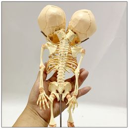 Decorative Objects Figurines 37cm Human Double Head Baby Skull Skeleton Anatomy Brain Display Study Teaching Anatomical Model Halloween Bar Ornament 230508