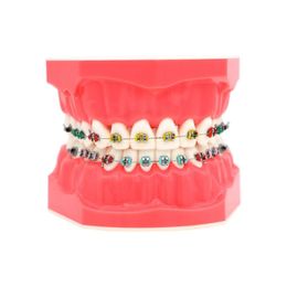 Other Oral Hygiene Dental Orthodontic Model with Bracket Arch Wire Ligature Tie 1 1 Standard Size Teeth Model Typodont Demo for Patients Students 230524