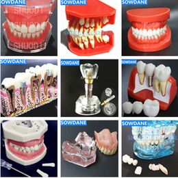 Other Oral Hygiene Dental Study Teaching Model Dental Impant Standard Model Removable Teeth ADULT Child TYPODONT Model Dentist Communication Model 230524