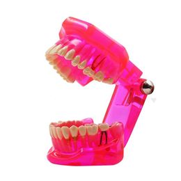 Other Oral Hygiene 1pc Dental Teeth Teaching Model Adult Pink Removable Tooth Orthodontic Standard Model For Patient Communication Study Model 230524