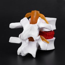 Other Office School Supplies Human Anatomical Lumbar Disc Herniation Model Learn Aid Anatomy Instrume D5 230703