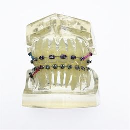 Other Oral Hygiene Dental Orthodontic Teeth Model Transparent Malocclusion With Brackets 230704