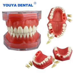 Other Oral Hygiene Dental Model Removable Teeth Model Detachable Implant Soft Gum Tooth Model Dentist Teaching Research Dentistry TYPODONT Model 230720