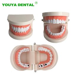 Other Oral Hygiene Dental Model Brushing Teeth Education Model Caries Tooth Care Oral Hygiene Studying Teaching Demonstration Tool 230728