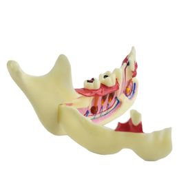 Dental Endodontic Treatment Model Anatomy Tissue Anatomical Model Anatomy Of Gums Study Dental Materials