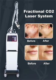 Top Sale Skin Resurfacing 10600nm Co2 Fractional Laser Machine Scar Removal Beauty Equipment