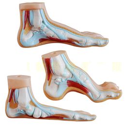 Foot Treatment Other Health Beauty Items Human Foot Model Foot Muscles Flatfoot Talipes Cavus Bow Foot Model Anatomical Teaching Model Freeship 230602