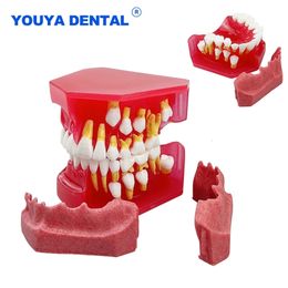 Other Oral Hygiene Dental Tooth Model Children Primary Permanent Teeth Alternate Deciduous Resin Teeth Model For Studying Teaching Communication 230617