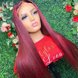 26Inch 150%Density Soft Long Straight Natural Colour Glueless Lace Front Wig For Black Women With Baby Hair