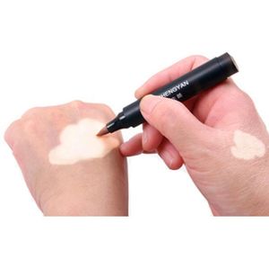 Hur man täcker vitiligo lappar vattentäta hud vita fläckar smink concealer långlastande leukodermi omedelbar makeup flytande penna 1pc3823504