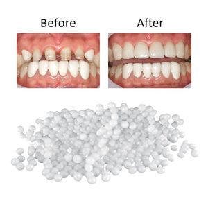 Dentes branqueamento 100g conjunto de reparação de dentes e lacuna dentes falsos cola sólida dentadura adesivo dentista resina gota temporária entrega saúde ser dhi78