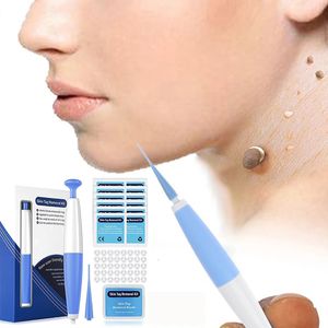 Removedor de verruga indolor caneta auto pele tag remoção kit mole acne verruga remoção caneta conjunto limpeza cotonetes corpo beleza cuidados ferramenta 240108