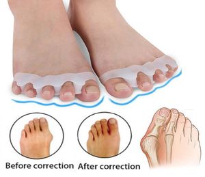 Hallux valgus hängslen tå separator överlappande tår rehabilitering behandling fot ben ort anordning fötter vård silikon gel buni2656995