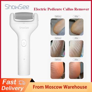 Files Showsee Electric Pedicure Portable Foot Grinder Feet Callus Remover USB Charging Dead Skin Remove For Hard Cracked Dry Skin Home