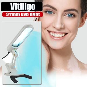 Анализатор Vitiligo Ultraviolet Light Therapy Lamp