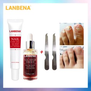 Pés lanbena reparação de unhas essência soro + cuidados com as unhas gel tratamento de unhas remover onicomicose dedo do pé prego nutritivo cuidados com as mãos e pés 2 peças